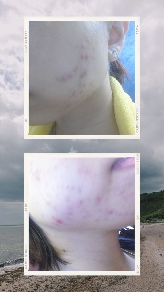 choosewitht-before-n-after
